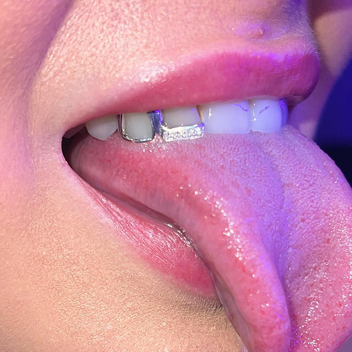 Cap with Moissanite Tip