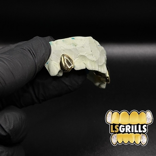 Plain Single Caps - (Optional), gold tooth cap